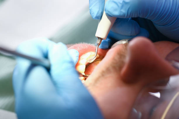 Best Emergency Tooth Extraction in Black Jack, MO