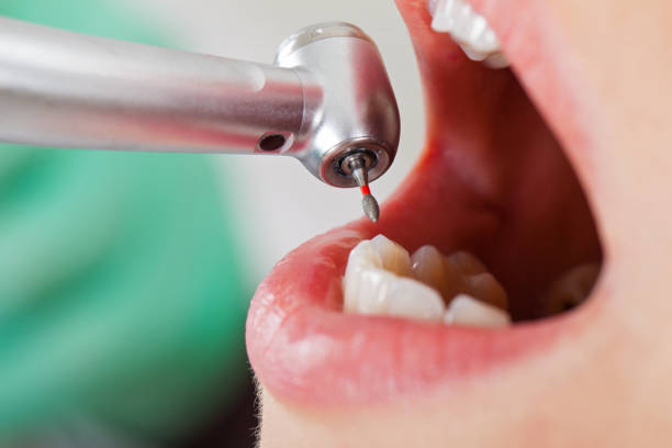 Best Emergency Treatment for Toothache in Black Jack, MO